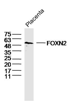FOXN2 Rabbit Polyclonal Antibody