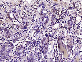 Phospho-FoxO1 (Ser329) Rabbit Polyclonal Antibody