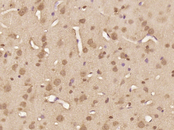 Phospho-FOXO4 (Thr451) Rabbit Polyclonal Antibody