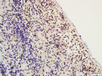 FOXP3 Rabbit Polyclonal Antibody