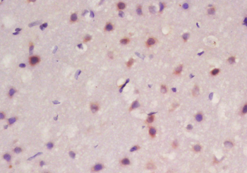 Frizzled 10/CD350 Rabbit Polyclonal Antibody