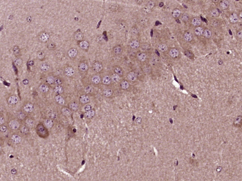 FTSJ1 Rabbit Polyclonal Antibody