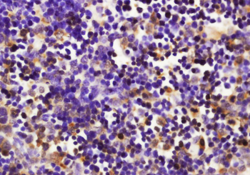 Furin Rabbit Polyclonal Antibody