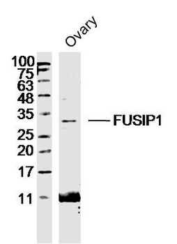 FUSIP1 Rabbit Polyclonal Antibody