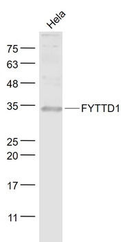 FYTTD1 Rabbit Polyclonal Antibody