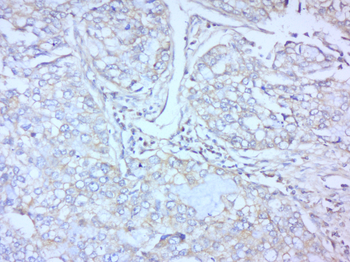 FZD3 Rabbit Polyclonal Antibody