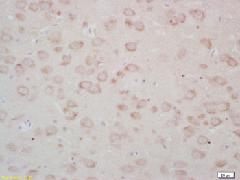 FZD3 Rabbit Polyclonal Antibody
