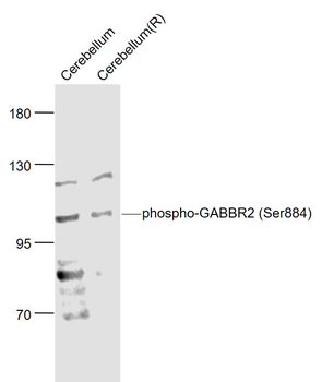 Phospho-GABBR2 (Ser884) Rabbit Polyclonal Antibody