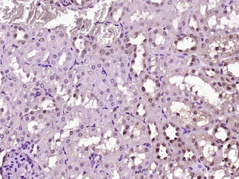 GABPA Rabbit Polyclonal Antibody