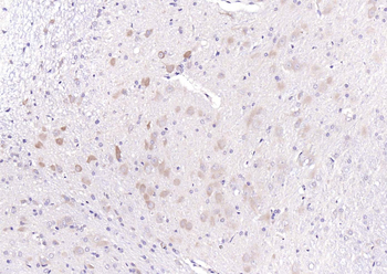 GABRB2 Rabbit Polyclonal Antibody