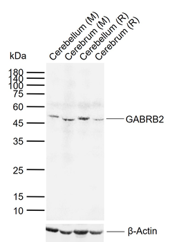 GABRB2 Rabbit Polyclonal Antibody