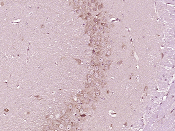 Phospho-GABRG2 (Ser366) Rabbit Polyclonal Antibody