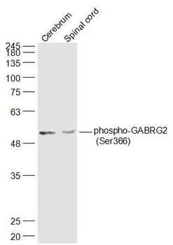 Phospho-GABRG2 (Ser366) Rabbit Polyclonal Antibody