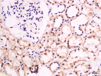 Galactosylceramidase Rabbit Polyclonal Antibody