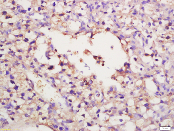 Galactosylceramidase Rabbit Polyclonal Antibody