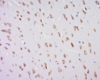 Galactosylceramidase Rabbit Polyclonal Antibody