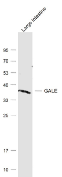 GALE Rabbit Polyclonal Antibody