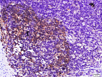 Galectin 3 Rabbit Polyclonal Antibody