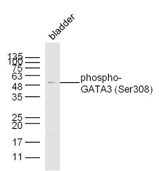 Phospho-GATA3 (Ser308) Rabbit Polyclonal Antibody