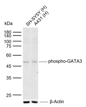 Phospho-GATA3 (Ser308) Rabbit Polyclonal Antibody