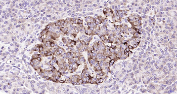 GBA Rabbit Polyclonal Antibody