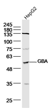 GBA Rabbit Polyclonal Antibody