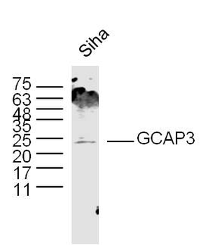 GCAP3 Rabbit Polyclonal Antibody