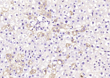 GCHFR Rabbit Polyclonal Antibody