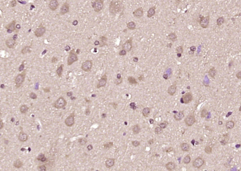 GEFT Rabbit Polyclonal Antibody