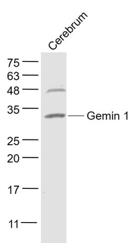 Gemin 1 Rabbit Polyclonal Antibody