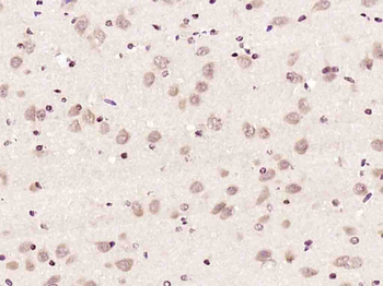 Gemin 2 Rabbit Polyclonal Antibody