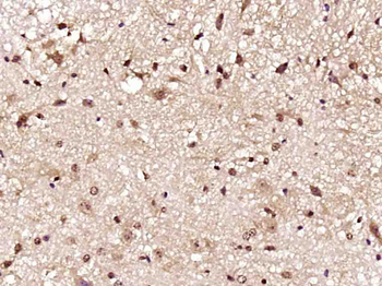 Gemin 2 Rabbit Polyclonal Antibody