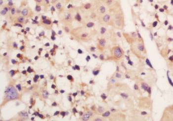 Genethonin 1 Rabbit Polyclonal Antibody
