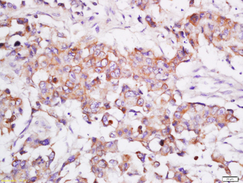 GFPT1 Rabbit Polyclonal Antibody