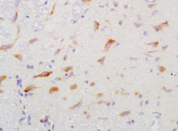 GGA2 Rabbit Polyclonal Antibody