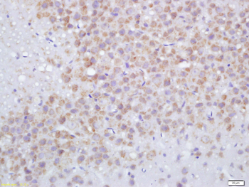 GGA2 Rabbit Polyclonal Antibody