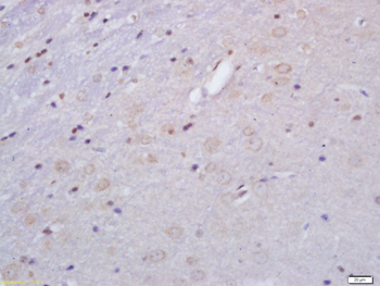 GHRHR Rabbit Polyclonal Antibody