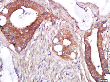 Giantin Rabbit Polyclonal Antibody