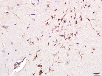 Giantin Rabbit Polyclonal Antibody