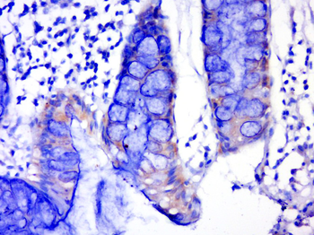GK2 Rabbit Polyclonal Antibody