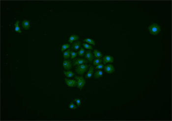 Gli2 Rabbit Polyclonal Antibody