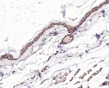 Gli2 Rabbit Polyclonal Antibody