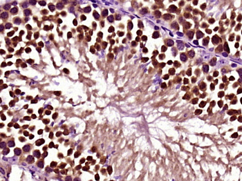 Gli3 Rabbit Polyclonal Antibody