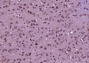 GLS1 Rabbit Polyclonal Antibody