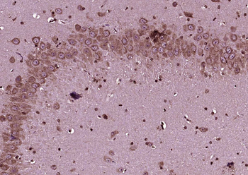 GLS1 Rabbit Polyclonal Antibody