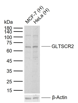 GLTSCR2 Rabbit Polyclonal Antibody