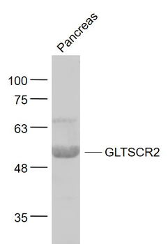 GLTSCR2 Rabbit Polyclonal Antibody