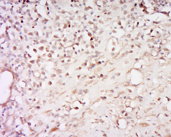 Phospho-Glucocorticoid Receptor (Ser226) Rabbit Polyclonal Antibody