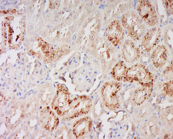 Phospho-Glucocorticoid Receptor (Ser226) Rabbit Polyclonal Antibody