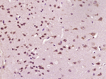 Glucocorticoid Receptor Rabbit Polyclonal Antibody